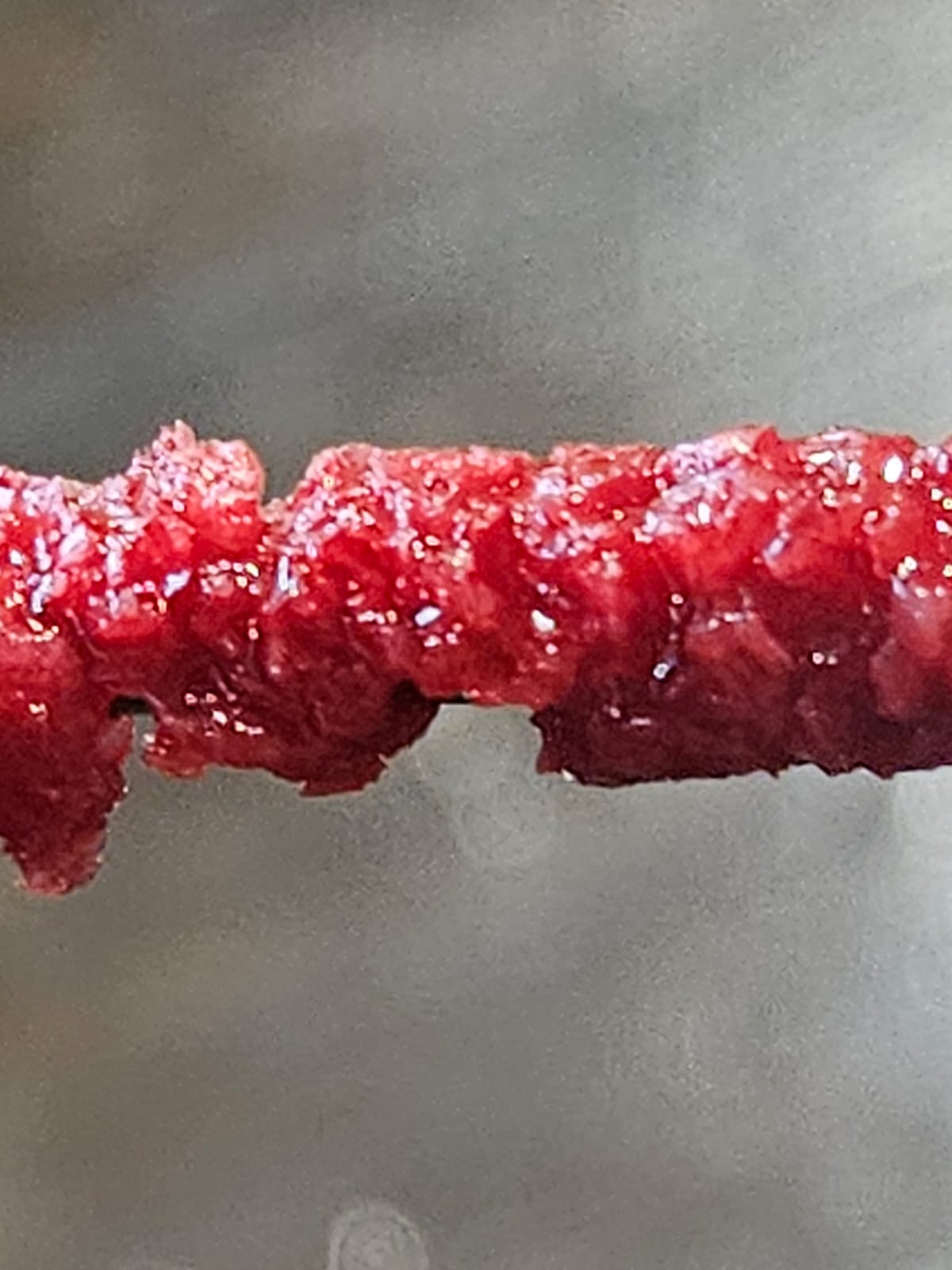 BoneGainer — klinische Anwendung