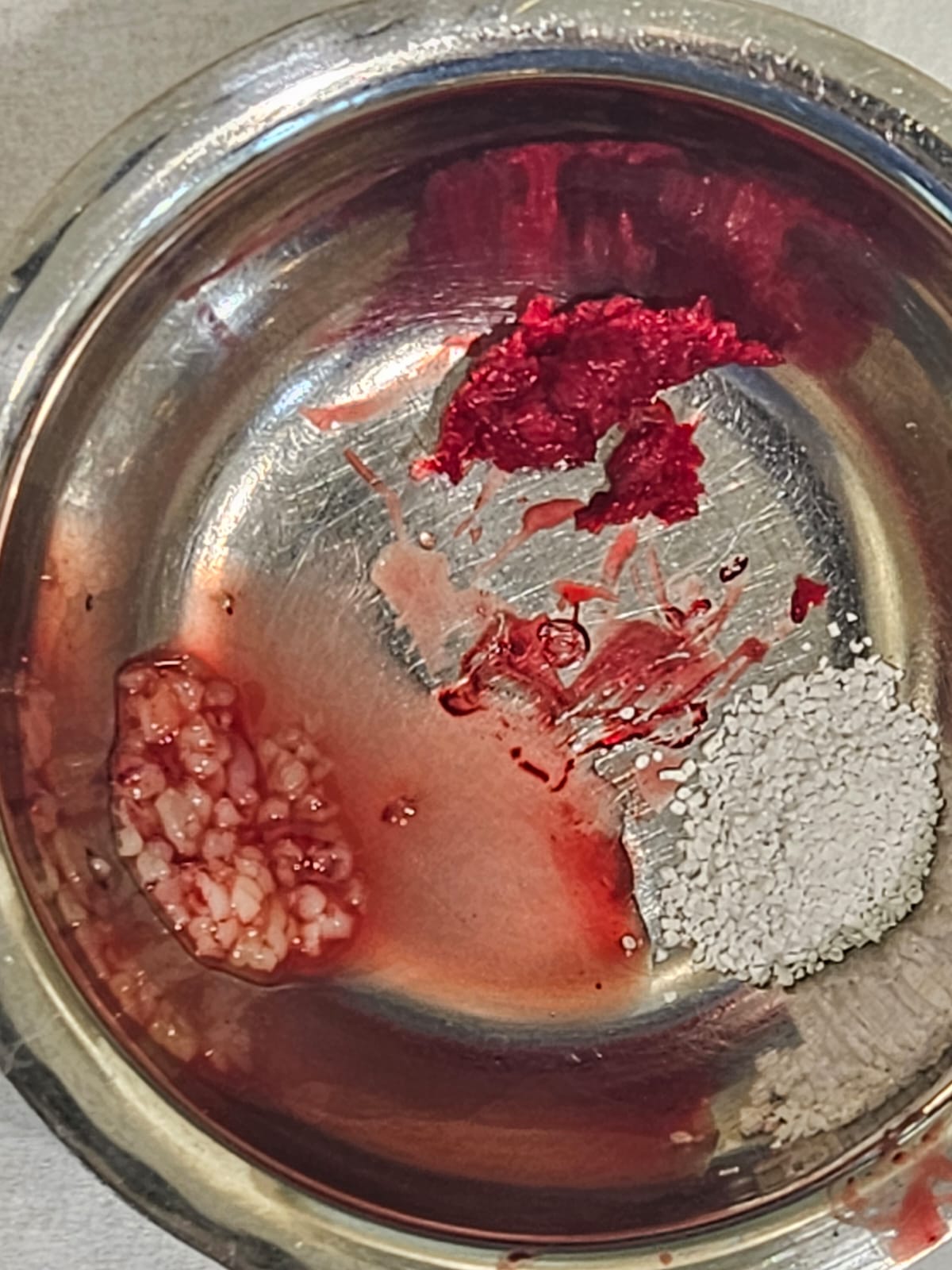 BoneGainer — klinische Anwendung