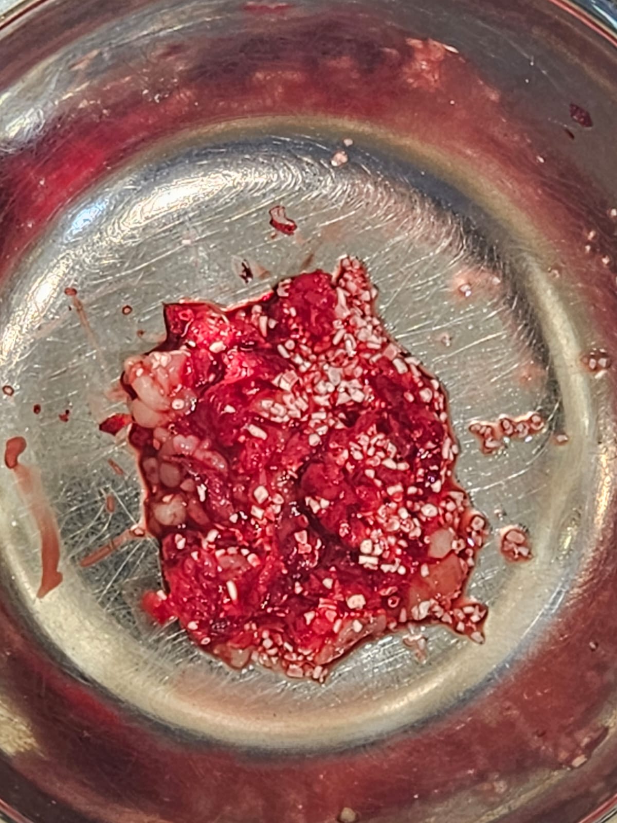 BoneGainer — klinische Anwendung
