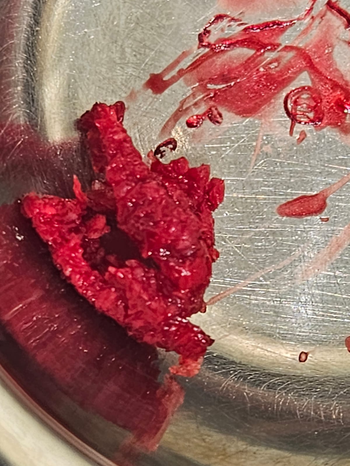 BoneGainer — klinische Anwendung