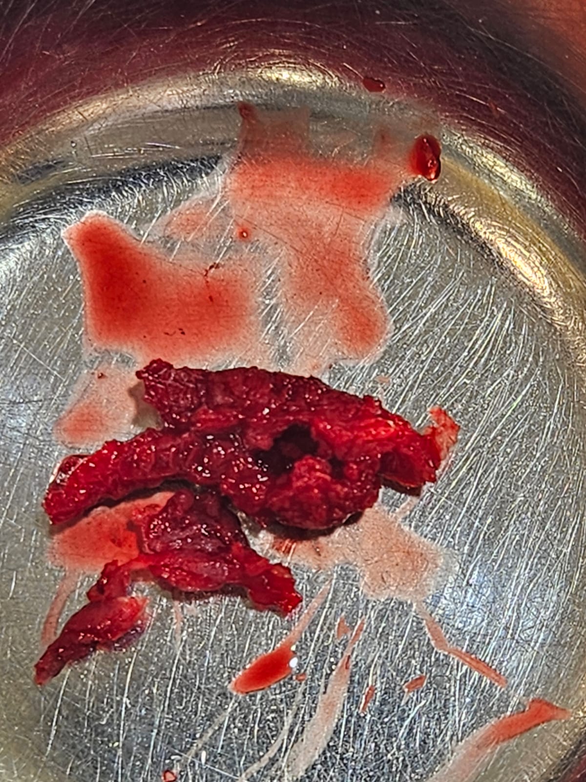 BoneGainer — klinische Anwendung